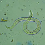 Intestinal Parasites
