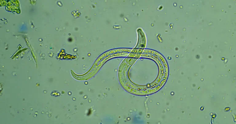 Intestinal Parasites
