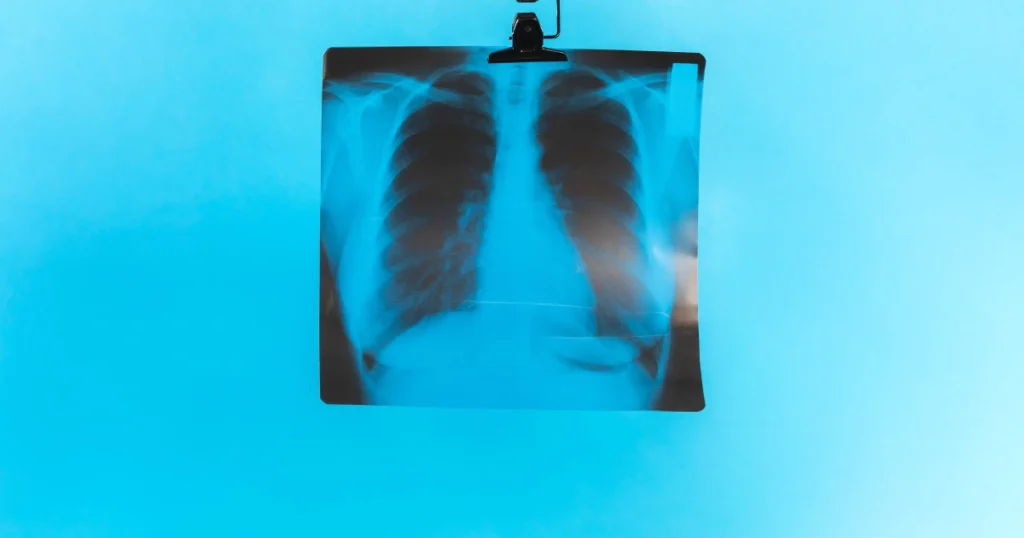 Celebrating Medical Imaging Today