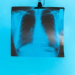 Celebrating Medical Imaging Today