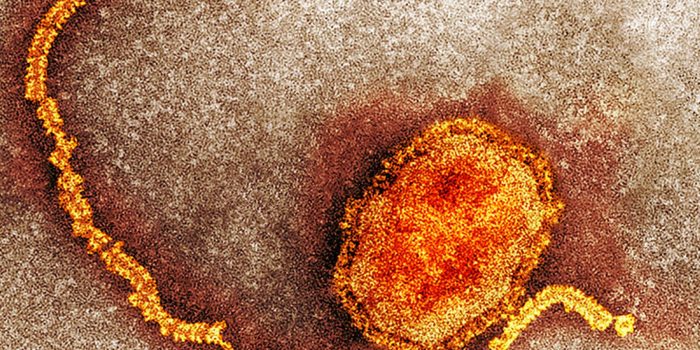 00HS-measles-01-mediumSquareAt3X-63E2Nn-rss