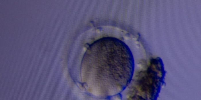 00HiddenEggs-06-fwvq-mediumSquareAt3X-v2-w5OpB8-rss