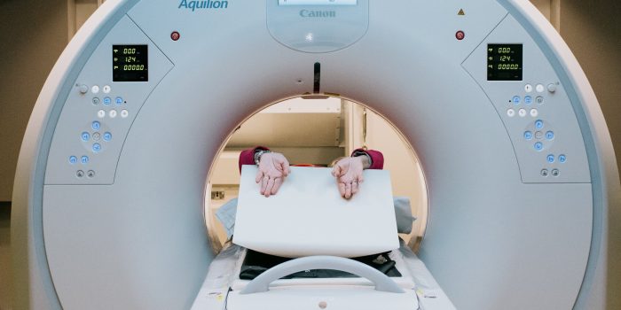 00SCI-LUNGCANCER-SCREENING-BUS-01-tqhg-mediumSquareAt3X-9tTtcY-rss