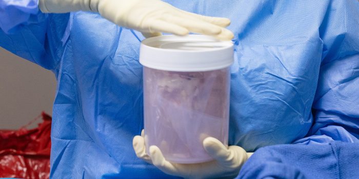 00inv-transplants-gzcb-mediumSquareAt3X-03K0fc-rss