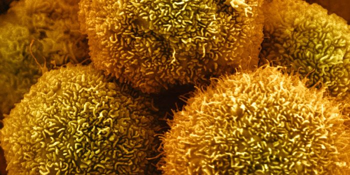 00sci-kras-cancer-mediumSquareAt3X-NNLtYq-rss