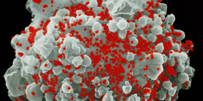 05HS-HIV-mediumSquareAt3X-YzCaHi-rss