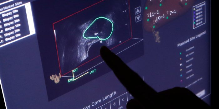 08HS-cancer-mediumSquareAt3X-PkrGIP-rss