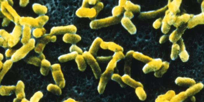 09SCI-ORIGINS-DISEASE-mediumSquareAt3X-1UdXla-rss