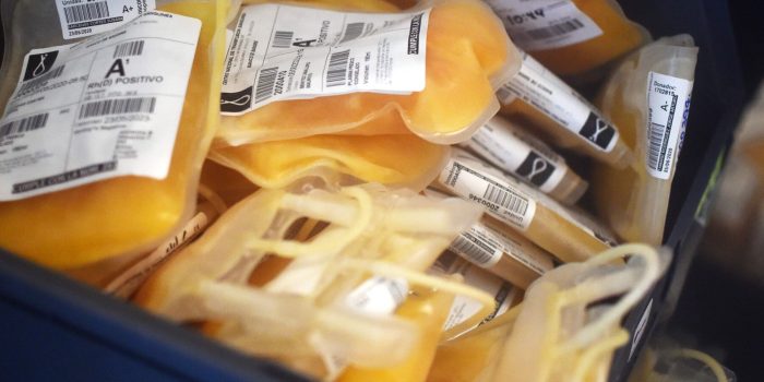 12HS-plasma-01-zgkm-mediumSquareAt3X-ZhV3cT-rss