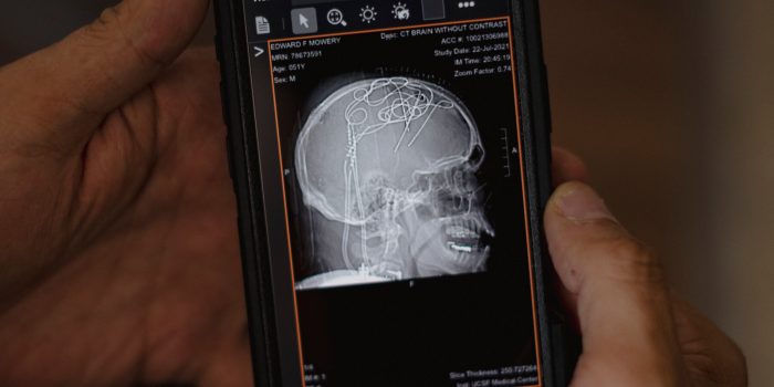 14HS-ChronicPain-HP-Promo-copy-mediumSquareAt3X-fE11b7-rss