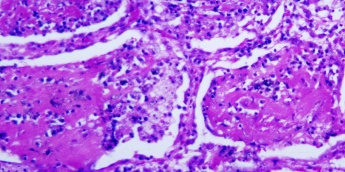 20xp-fungus-mediumSquareAt3X-HiQmY8-rss