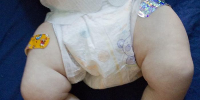 Baby20injection20bandaid-Quinn20Daedal_0-m5OePV-rss