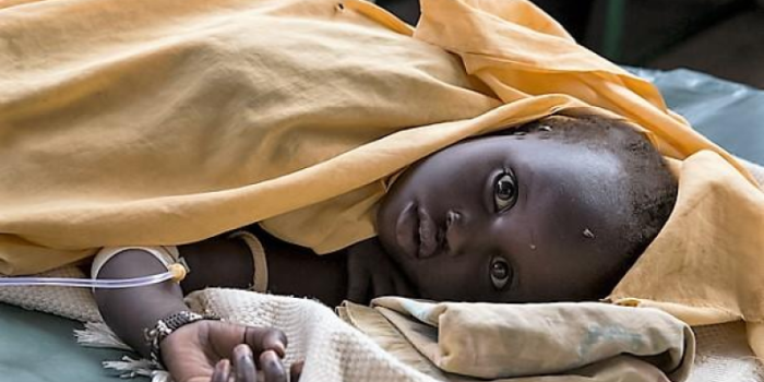Child20with20cholera_0-mrxuyE-rss
