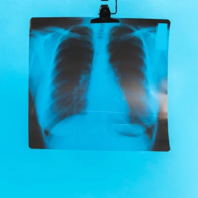 Celebrating Medical Imaging Today