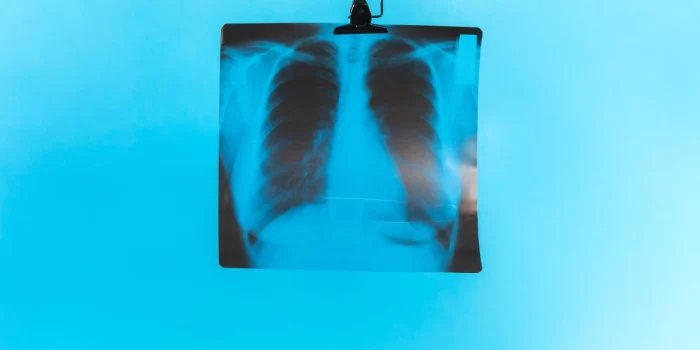 Celebrating Medical Imaging Today