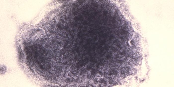 Measles20virus-vertical-CDC-3eDzBX-rss