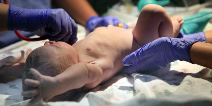 Newborn20with20gloved20HCWs-AAo2jM-rss