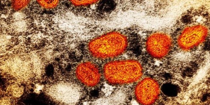 Orange20mpox-CDC-vSPHmn-rss