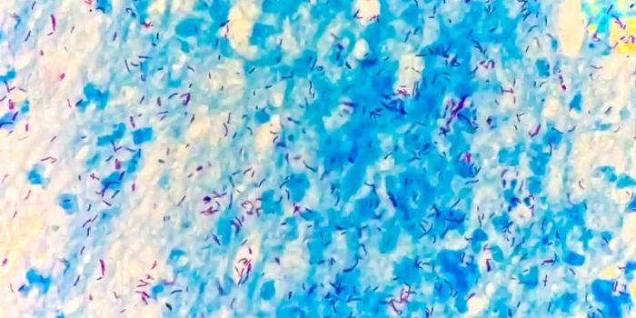 Tb20bacteria-LGUOFp-rss