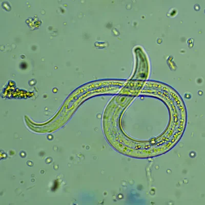 Intestinal Parasites