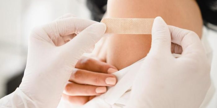 Young20woman20arm20with20bandaid-RyOX7B-rss