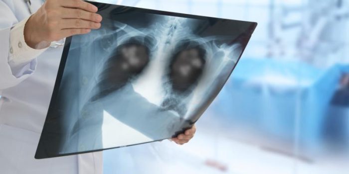 iStock-1210038548-dzbmjp-rss