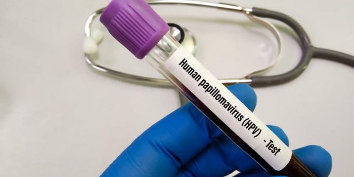 iStock-134685390220HPV-M9I3Xv-rss