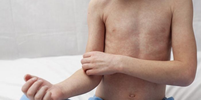 iStock-2209741697-qPb3pS-rss