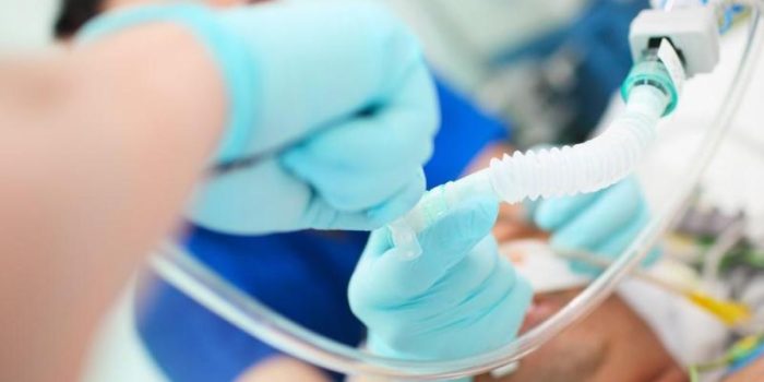 intubation_equipment-UVuFRb-rss