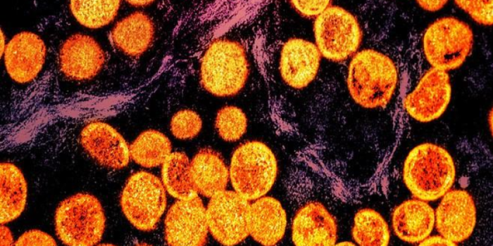 mpox20virus20image-Gsln8U-rss