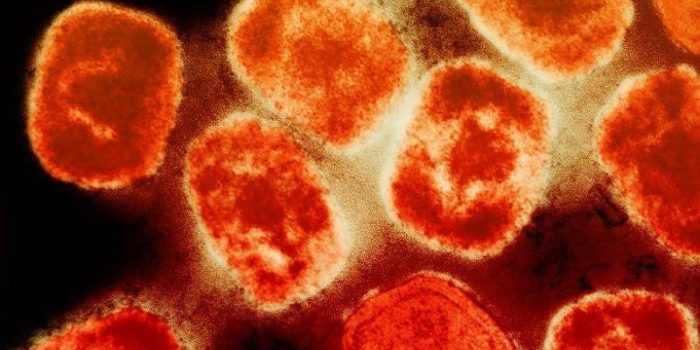 mpox20virus20particles20burnt20orange_0-NJYpt9-rss